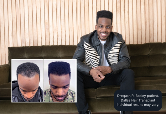 Drequan R. Bosley patient. Atlanta Hair Transplant individual results may vary.