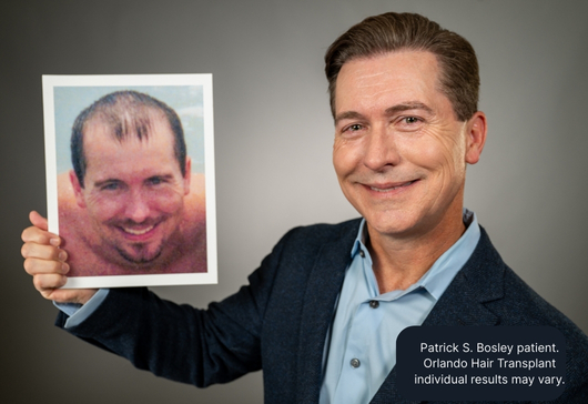 Patrick S. Bosley patient. Atlanta Hair Transplant individual results may vary.
