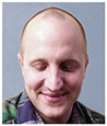 Bosley patient Nick before