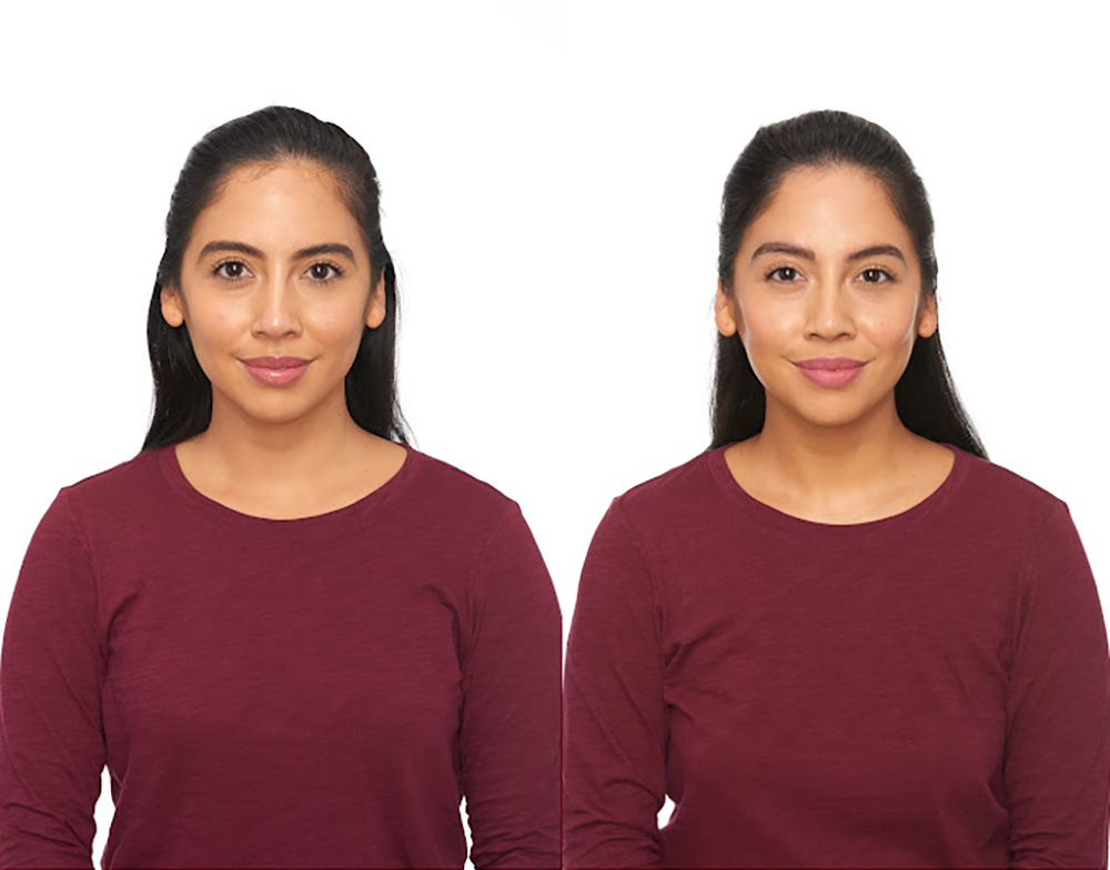 Bosley patient Amanda E before and after