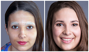 Bosley eyebrow restoration patient Kristen before and after