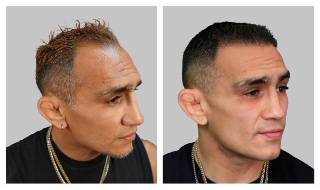 Tony Ferguson-LP-Image-B&A (1)