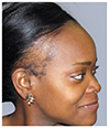 Bosley Baltimore | Hair Transplant Location