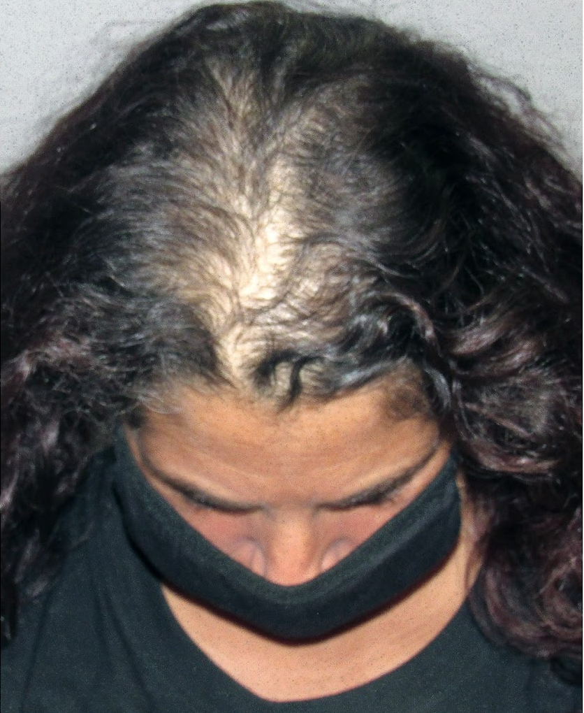 Charlene DeCicco - SMP - Antes