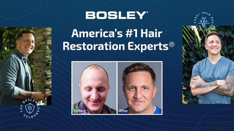 Bosley Hair Restoration Locations Near Me - Bosley Hair Transplant
