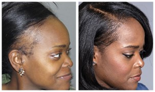 Kelly S. - Before and After