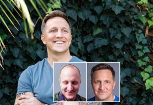 Nick H. Paciente real de Bosley Hair Transplant New York. Los resultados individuales pueden variar.
