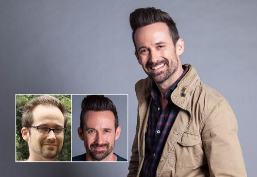 John W. Bosley Hair Transplant Atlanta Paciente. Los resultados individuales pueden variar.
