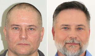 Bosley patient Joe O. Before and after