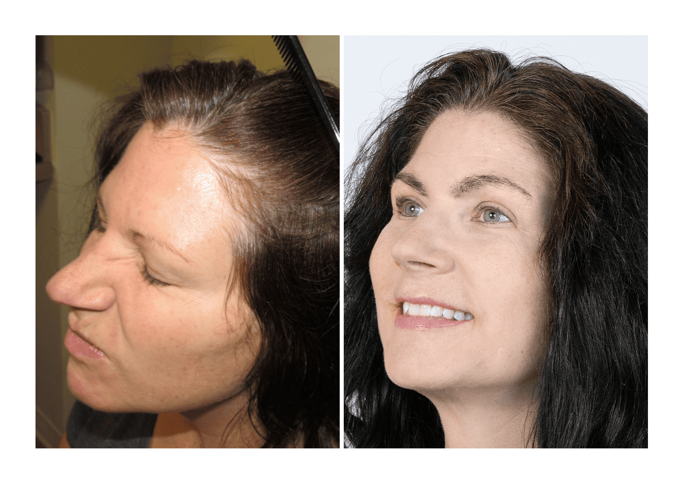 Experience The B07S113D88 Difference: Before & After Results