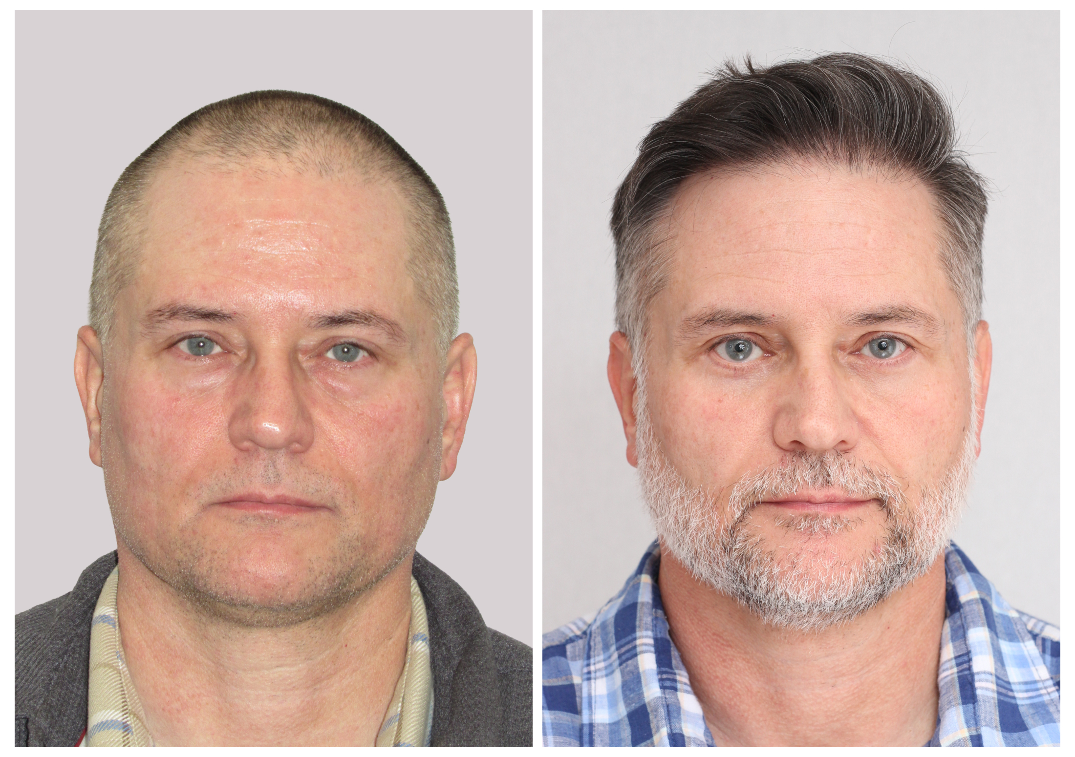 Joe O. Before and After