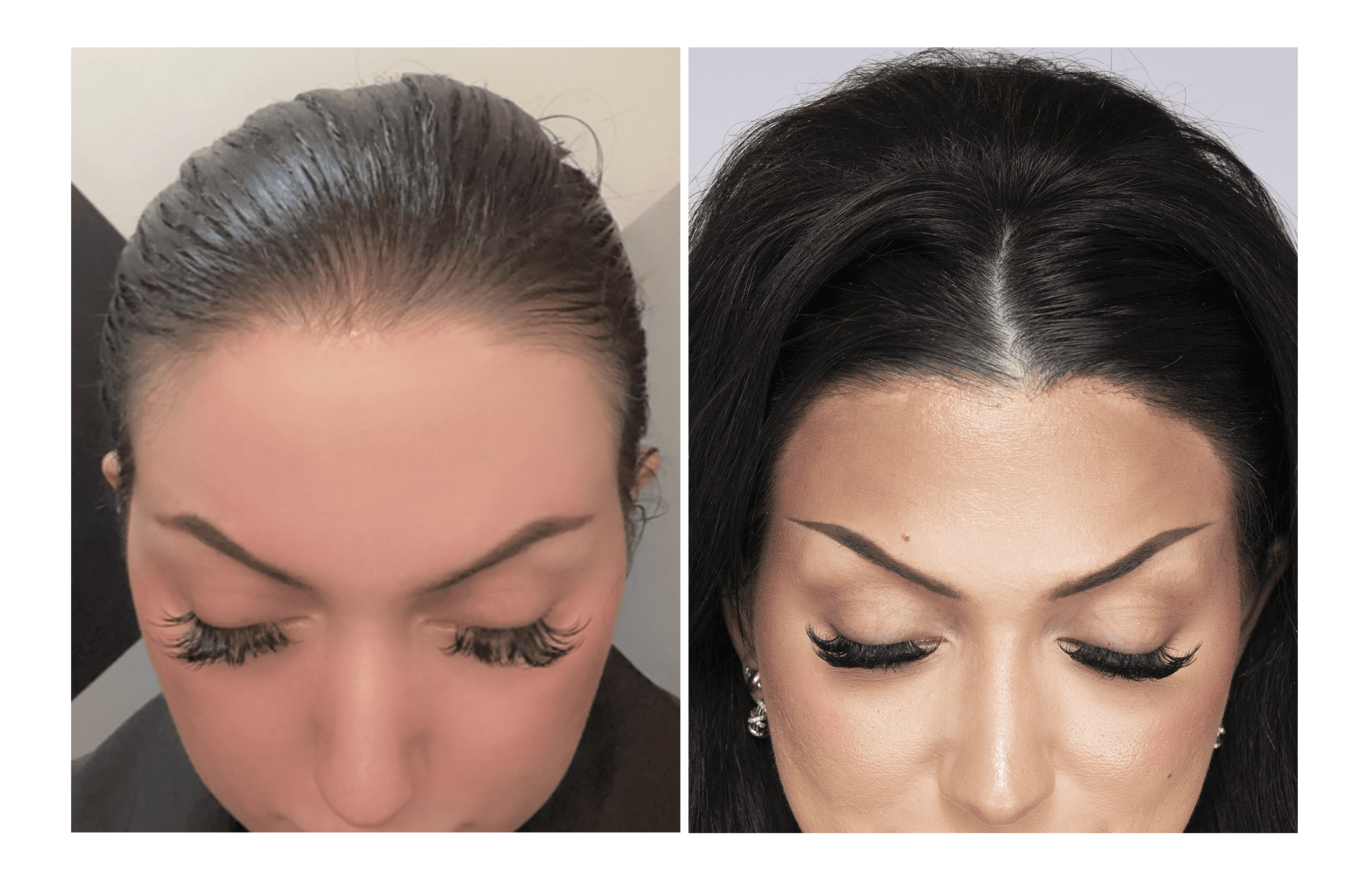 Bosley patient Britany Geidl before and after pictures