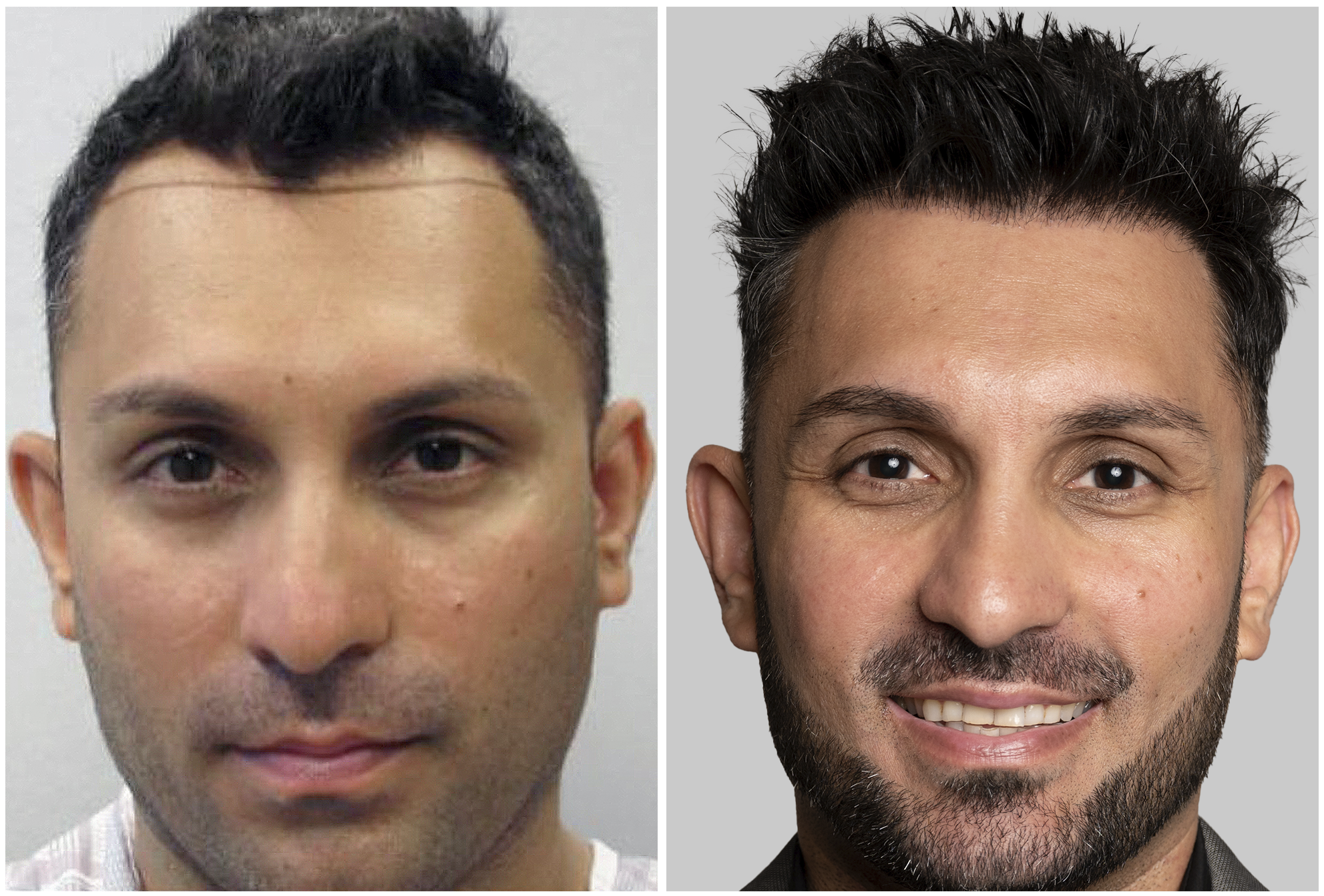 Amier Qureshi - After 2nd