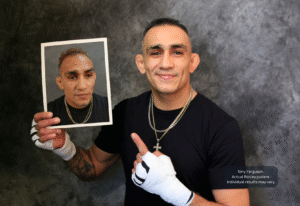 bosley-mma-legends-hair-transplant-partnership