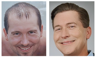 FriendsandFamily-BeforeAfter